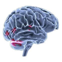 after EMDR 403c4ab1
